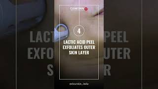 Effective Melasma Treatment QSwitch Laser vs Lactic Acid Peel Combo  Clear Skin Pune [upl. by Adnaral]