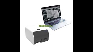 Digital Dental XRay Image Plate Scanner Dental Scanner Digital Dental CR Imaging System [upl. by Terina]