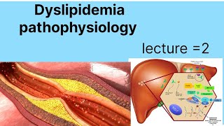 Pathophysiology of hyper dyslipidemia  dyslipidemia types and causes  hypercholesteolemia [upl. by Gottlieb]