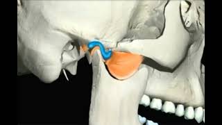 TMJ Anterior Disc Displacement [upl. by Anile]