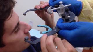 Clinical Demonstration of How to Use a Facebow [upl. by Norrahs]