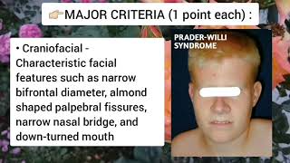 Prader Willi Syndrome Genetics Symptoms and Diagnosis [upl. by Winfield]