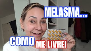 COMO ACABEI COM O MELASMA EM CASA PASSO A PASSO [upl. by Noy]