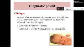 ICTERES NEONATAUX Dr DJEGHALI [upl. by Yerdua]