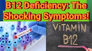 The Hidden Dangers of Vitamin B12 Deficiency Causes and Symptoms [upl. by Notnerb380]