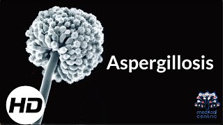 Aspergillosis Everything You Need To Know [upl. by Ahsienom]