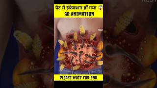 पेट में इंफेक्शन हो गया 😱  got a stomach infection  3d animation  asmryoutubeshorts [upl. by Bobine]