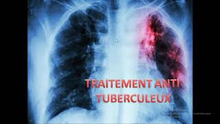 TRAITEMENT ANTI TUBERCULEUX ALGERIE [upl. by Lua]