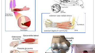 AULA 3 Fisioterapia no Cotovelo e Punho [upl. by Tilly]