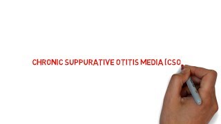 CHRONIC SUPPURATIVE OTITIS MEDIA CSOM   lecture  NEET PG  NOTES [upl. by Kitti416]