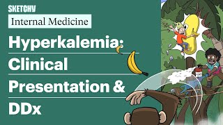 Learn Hyperkalemia Clinical Presentation amp DDx Internal Medicine  Sketchy Medical [upl. by Nwahshar]