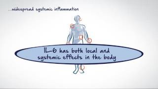 The role of interleukin6 in autoimmune diseases [upl. by Chesney]