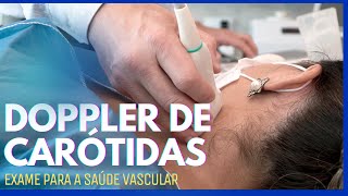 Ultrassom Doppler de Carótidas e Vertebrais O que é esse Exame doppler dopplerdecarotidas [upl. by Giorgi]