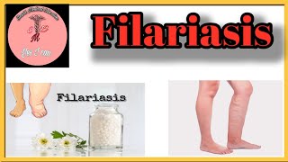 Filariasis l Causes l Sign amp Symptoms l Management [upl. by Merriott]