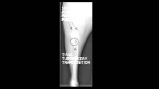 Medial Patellar Luxation explained by Dr Bauer [upl. by Ahron952]