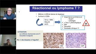 DES Hématologie 20202021  Lymphome T [upl. by Chu66]