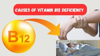 Causes of Vitamin B12 Deficiency You Never Knew  Medications and Vitamin B12 Deficiency [upl. by Kcirddet218]