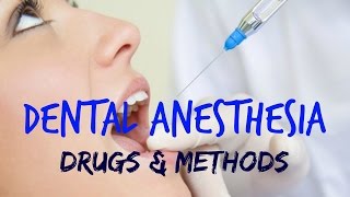 Dental Anesthesia [upl. by Anana690]