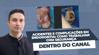 Acidentes e Complicações em Endodontia Como trabalhar com segurança dentro do canal [upl. by Lottie]