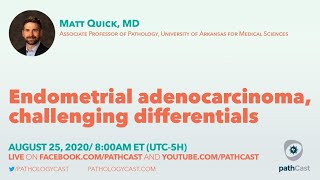 Endometrial adenocarcinoma challenging differentials  Dr Quick UAMS GYNPATH [upl. by Diandra]