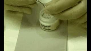 Applying Coltosol Temporary ZincOxide cement [upl. by Lled]