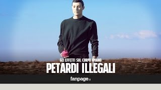 Gli effetti devastanti di un petardo illegale sul corpo umano [upl. by Thorvald]