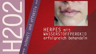 Wasserstoffperoxid gegen Herpes720p [upl. by Anileuqcaj]