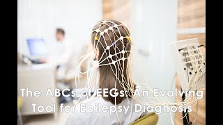 The ABCs of EEGs An Evolving Tool for Epilepsy Diagnosis [upl. by Koh399]