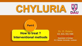 CHYLURIA treatment by interventional methods [upl. by Finella]