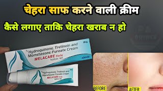 melacare forte cream  melacare forte cream uses in hindi  melacare cream  Prince Azeemuddin [upl. by Obed]