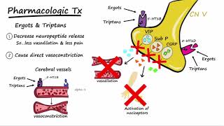 Migraines  Pathophysiology amp Treatment Described Concisely [upl. by Joliet]