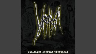 Dislodged Beyond Treatment [upl. by Lasiaf]