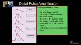 Arterial line Techniquestipschallenges and interpretationDrASArunkumar [upl. by Polash220]