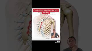 Costochondritis and anxiety [upl. by Scarlet]