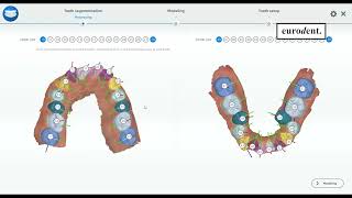 Orthosimulador Eurodent Forestadent [upl. by Elleined]