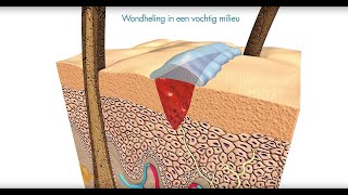 Flamigel  Vochtige wondheling met Flamigel [upl. by Eednam894]