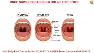 NORCET Booster Series Part 2  High Yield Clinical MCQs by Sharma Sir norcet7 rncctestseriesnorcet [upl. by Diaz]