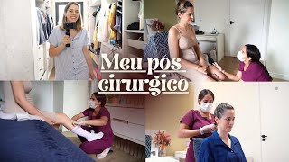 Como está sendo a minha recuperação pós abdominoplastia [upl. by Airot158]