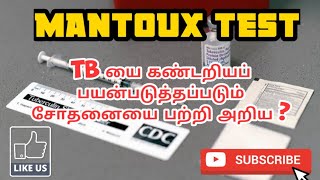 MANTOUX TEST  USES  METHOD  PROCEDURE  PHARMA TAMIL  AKI 46 [upl. by Wight]