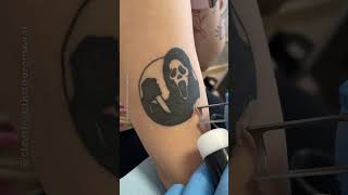 The ABSOLUTE TRUTH About Tattoo Removal Pain Revealed [upl. by Arramahs700]