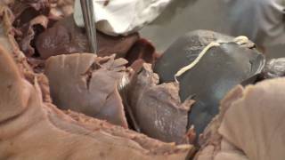 Fetal Pig Dissection  Locations and Review of Heart Parts [upl. by Bertasi831]