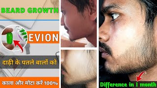 BEARD GROWTH  FROM EVION 400 □ Best beard growth soulation  दाढ़ी को मोटा और काला कैसे करें [upl. by Rabi9]