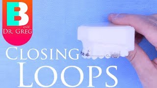 BRACES EXPLAINED Closing Loops [upl. by Ahsinit758]