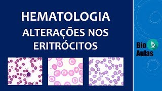 Anisocromia Anisocitose e Poiquilocitose Alterações no Hemograma Hematologia  Bio Aulas [upl. by Nnyre]