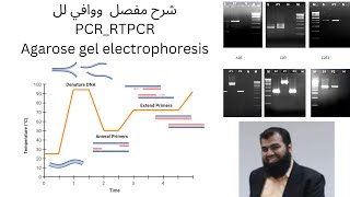 PCR RT PCR and Agarose gel electrophoresis [upl. by Uyerta]