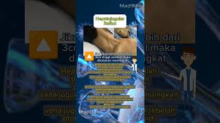 Hepatojugular Reflux medical medicalstudent keperawatan diagnosis doctor youtubeshorts [upl. by Shaper]