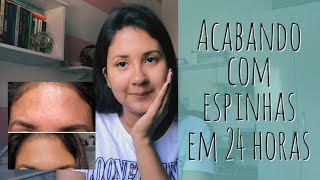 Como acabar com espinhas em 24 horas  SEM CLICKBAIT [upl. by Naltiak]