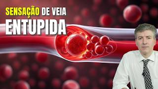 Doutor Revela Verdade Sobre Veias Entupidas [upl. by Anitirhc]