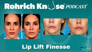 Lip Lift Finesse [upl. by Drarehs]