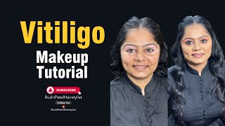 vitiligo skin makeup tutorials [upl. by Charry435]